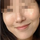 백옥 티스토리