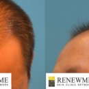 리뉴미피부과의원 이미지