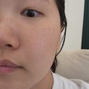 세븐일레븐 광주장덕행복점 | 광주피부관리 한스라벨르 수완장덕점 스킨부스터 관리 후기