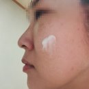 메디에셋 | 촉촉한로션, 올인원로션 추천 : 메디블레스 바이탈베리어로션