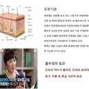 비사이
