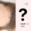 [춘천 헤어라인 문신 잘하는곳 추천] 헤어라인반영구 시술소요시간? 관리방법? 주의사항?