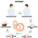 이석치환술 - 어지럼증 원인과 치료법 이미지