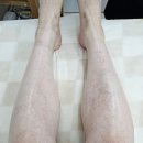 부산진 왁싱 초량 차니야뷰티 남자 다리 후기