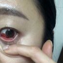 혜민안과병원 이미지