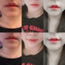 신사엘성형외과의원 | [내 돈 내산] 신사역 어린 공주 성형외과의원 입술필러 후기♡