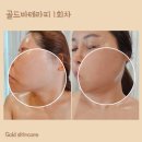 골드스킨&바디 이미지