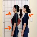아모르체형교정
