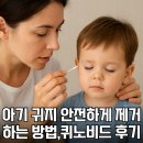 라니블 | 아기 귀지제거 해야할까? 귀지 불리는 퀴노비드 병원에서 귀지제거 후기