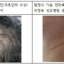 인뉴스TV 기사 두번째 약물을 이용한 전파무기 마인드컨트롤 이미지