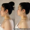 앤유PC | 노원 공릉동 피부관리 뷰티라보앤유 아프지 않은 예신 웨딩케어 후기