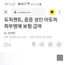 듀피젠트, 중증 성인 아토피피부염에 보험 급여 이미지