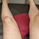 개금한의원 | 개금백병원피부과? 약과 주사를 계속 맞았던 분들이 놓친 1가지