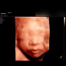 송정오리농장 | 3월| 임산부의 새학기일상 • 봄도다리와 대게 • 모모스커피 • 송정흑송 • 입체초음파 후기