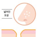 모공화장품