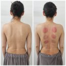 씨유진주주약한주점 | [진주더안뷰티] 주약동 피부샵 50대 등관리 잘하는 곳! 노폐물제거!