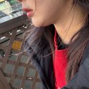 (주)글로벌라인 | 압구정로데오 피부과 추천 | 이중턱 지방파괴주사 바이블주 통증 후기