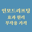 인모드 리프팅 효과 원리 부작용 가격 전후사진(ft. 써마지 LFX 올리지오와 차이) 이미지