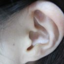 귀건강이혈테라피 이미지