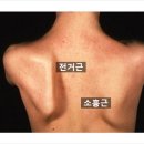 머슬큐어 이미지