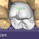 윤치과기공소 이미지