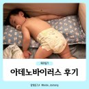 삼일어린이집 | 아기 아데노바이러스 증상 고열 검사 일주일 후기