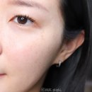 브리즌의원 네이버블로그