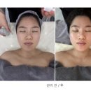 241 | [김해 장유 피부관리] 에스페레 에스테틱, 12년 경력 원장님의 1:1 맞춤 ‘데일리 페이스’ 케어 후기