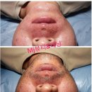 텐미닛태닝