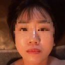 건강관리실 | 포항 문덕 피부관리 찾는다면? MTS 관리 받고 피부결이 달라진 그녀의관리실 후기