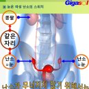 눈에서 나오는 땀은 눈물 꽃~난소와 불알을 향기롭게 이미지