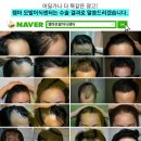 젬마헤어라인
