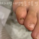 베티네일 이미지