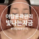 올토탈PC | 빛나는지금 야탑점 윤곽관리 후기, 30대 직장인 정체된 림프 순환으로 붓기 싹 빼고 온 솔직 후기