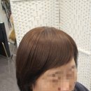 김호증모가발by헤어리서치 이미지