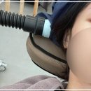 동탄탈모두피본연 이미지