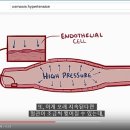 책에서도 안나오는 유익한 의학정보! 간호사/의사/간호대생/의대생/의료인 여새들의 머리채를 잡게따!!! 이미지