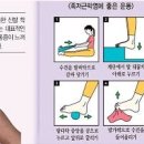 발등통증 원인 발통증 부위 증상 연관 질환 치료 이미지