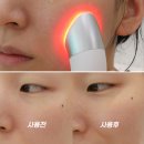 "얼굴 기미를 홈케어로?" 피코세라 부스터즈 프로 사용법 5일차 후기