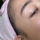 역삼피부관리 &#39;일라에스테틱&#39; 스킨플래닝 솔직후기