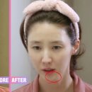 베스트메디필 이미지