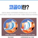 코골이 고치는법 원인과 코골이 방지 기구 이미지