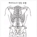 [ 허리디스크 | 봉침요법 ] 이미지