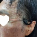별내굿타임의원 | 별내 리쥬란 후기예요~
