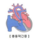 총동맥간증[Persistent truncus arteriosus]소아청소년질환, 순환기질환 이미지