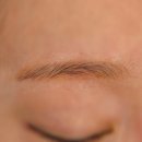 더래쉬 | 청주잔흔제거 개신동 래쉬더롱 눈썹문신 잔흔 1회 후기 (붉은기 변화)