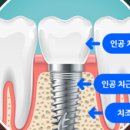 서울이수플란트치과의원 이미지