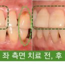 연세바른치과 이미지