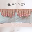 광주 네일바디 손톱 교정 관리 기록 | 예정보다 빠른 종료 후기