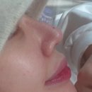 미코코 | 홍대 폼미코(코리프팅) 후기